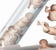 男性确诊不育症，试管怎么治疗效果比较好？